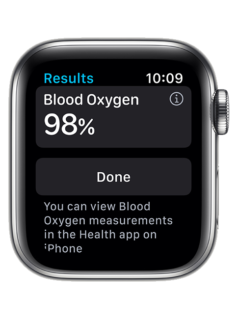 Apple Watch Series 6 - 40mm